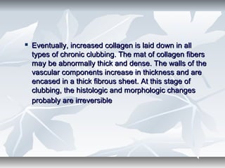  Eventually, increased collagen is laid down in allEventually, increased collagen is laid down in all
types of chronic clubbing. The mat of collagen fiberstypes of chronic clubbing. The mat of collagen fibers
may be abnormally thick and dense. The walls of themay be abnormally thick and dense. The walls of the
vascular components increase in thickness and arevascular components increase in thickness and are
encased in a thick fibrous sheet. At this stage ofencased in a thick fibrous sheet. At this stage of
clubbing, the histologic and morphologic changesclubbing, the histologic and morphologic changes
probably are irreversibleprobably are irreversible
 