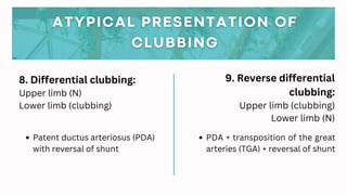 Clubbing Pathophysiology Notes Clubbing (General Medicine) by SSH.pdf