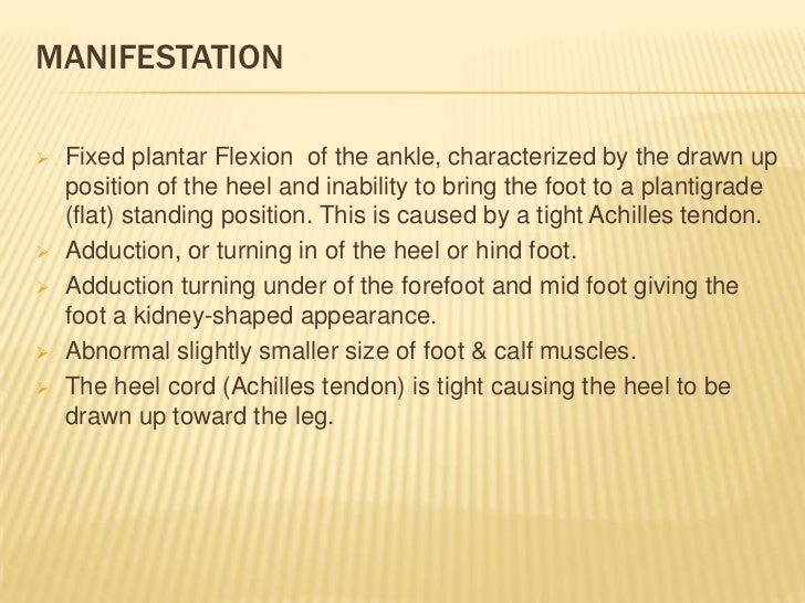 Club Foot