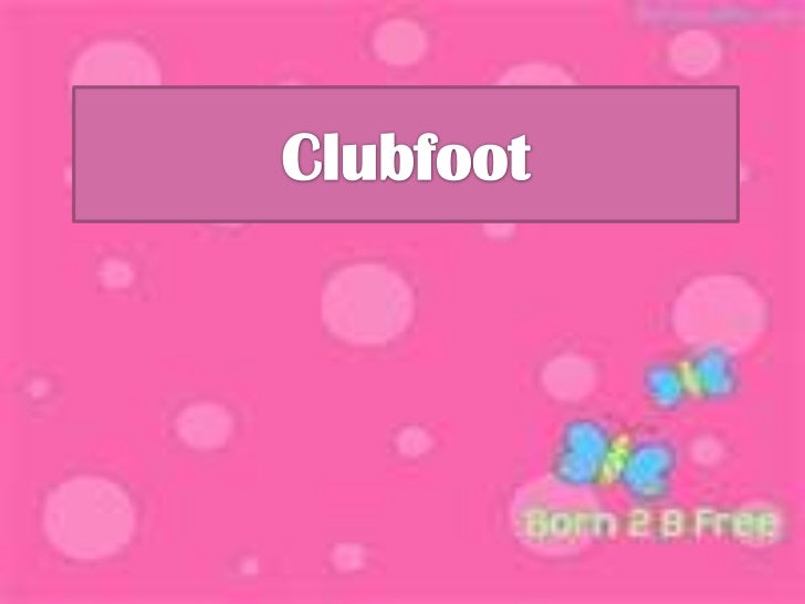 Clubfoot