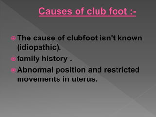 Club Foot