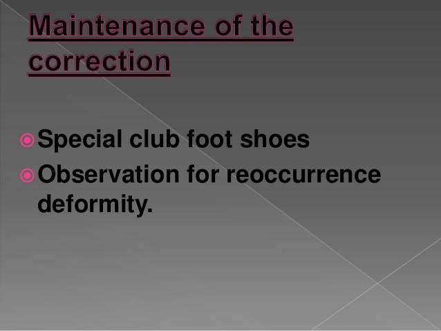 Club Foot