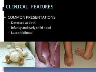 CLINICAL FEATURES
 Seek a detailed family history of clubfoot or
neuromuscular disorders, and perform a general
examinati...