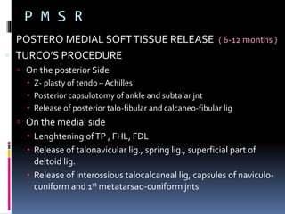 LIMITED SOFT TISSUE RELEASE
 When only one component present
 Equinus – posterior release
 Adduction – medial release
...