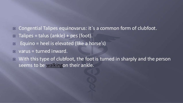 Club Foot Club Foot