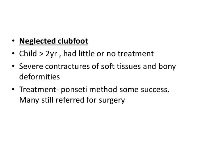 Club Foot