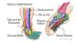 Ctev Types Club foot / CTEV | PDF