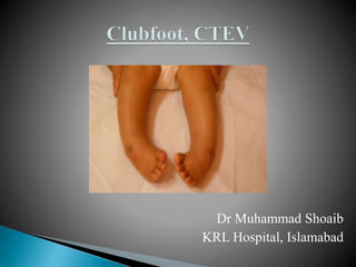 Dr Muhammad Shoaib
KRL Hospital, Islamabad
 