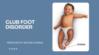 Comprehensive Overview of Club Foot Disorder: Causes, Types, Diagnosis ...