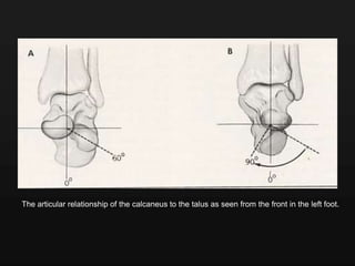 The articular relationship of the calcaneus to the talus as seen from the front in the left foot.
 