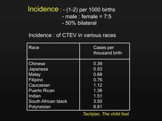 Incidence : - (1-2) per 1000 births
- male : female = 7:5
- 50% bilateral
Incidence : of CTEV in various races
Race Cases per
thousand birth
Chinese 0.39
Japanese 0.53
Malay 0.68
Filipino 0.76
Caucasian 1.12
Puerto Rican 1.36
Indian 1.51
South African black 3.50
Polynesian 6.81
Tachjian, The child foot
 