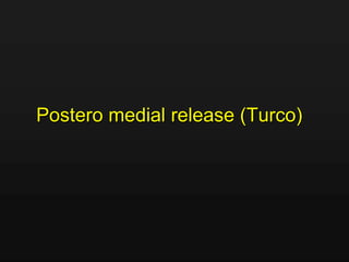 Postero medial release (Turco)
 
