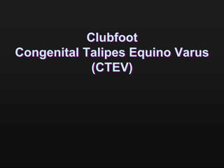 Clubfoot
Congenital Talipes Equino Varus
(CTEV)
 