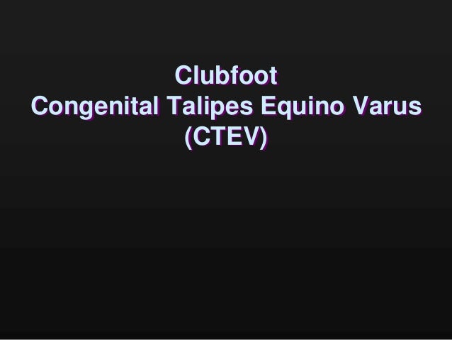 Club Foot Ctev
