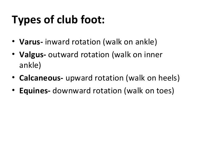 Club Foot 1 Club Foot 1