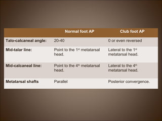 Normal foot AP
Club foot AP
Talo-calcaneal angle:
20-40
0 or even reversed
Mid-talar line:
Point to the 1st metatarsal
head.
Lateral to the 1st
metatarsal head.
Mid-calcaneal line:
Point to the 4th metatarsal
head.
Lateral to the 4th
metatarsal head.
Metatarsal shafts
Parallel
Posterior convergence.