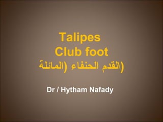 Talipes
Club foot
‫)القدم الحنفاء )المائلة‬
Dr / Hytham Nafady

 