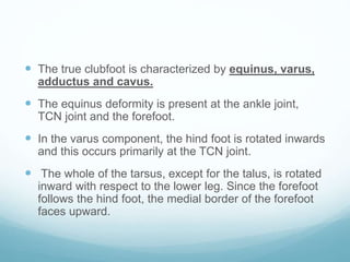 Clubfoot | PPTX