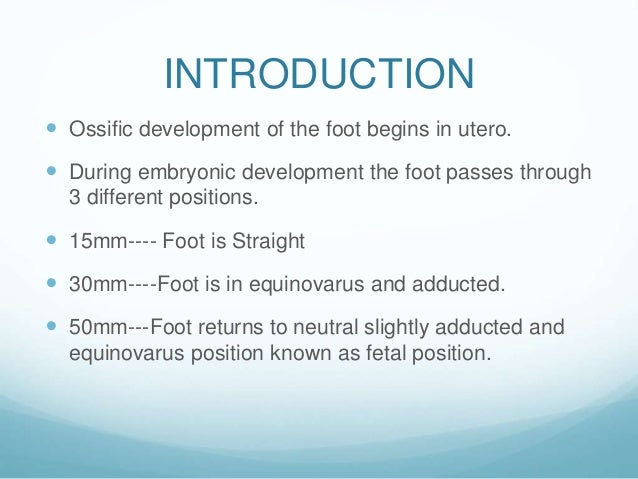 Clubfoot Clubfoot