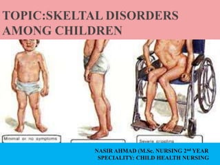 NASIR AHMAD (M.Sc. NURSING 2nd YEAR
SPECIALITY: CHILD HEALTH NURSING
 