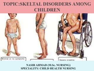 NASIR AHMAD (M.Sc. NURSING)
SPECIALITY: CHILD HEALTH NURSING
 