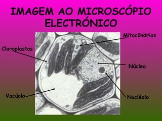 IMAGEM AO MICROSCÓPIO ELECTRÓNICO Mitocôndrias Núcleo Cloroplastos Vacúolo Nucléolo 