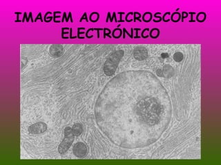 IMAGEM AO MICROSCÓPIO ELECTRÓNICO 