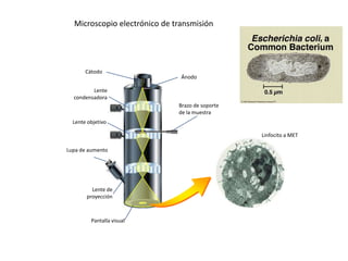 Cátodo
Ánodo
Lente
condensadora
Lente objetivo
Lupa de aumento
Lente de
proyección
Brazo de soporte
de la muestra
Pantalla visual
Linfocito a MET
Microscopio electrónico de transmisión
 