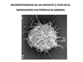 MICROFOTOGRAFIA DE UN LINFOCITO T VISTA EN EL
MICROSCOPIO ELECTRÓNICO DE BARRIDO
 
