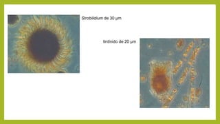 Strobilidium de 30 µm
tintínido de 20 µm
 
