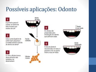 Possíveis aplicações: Odonto

 