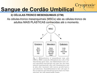 Sangue de Cordão Umbilical 2) CÉLULAS-TRONCO MESENQUIMAIS (CTM) As células-tronco mesenquimais (MSCs) são as células-tronco de adultos MAIS PLÁSTICAS conhecidas até o momento. 