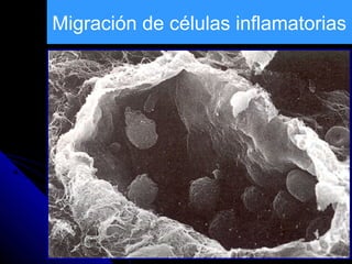 Migración de células inflamatorias
 