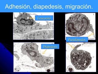 Adhesión, diapedesis, migración.
           Leucocito




                           Pseudópodos

              Diapedesis
 