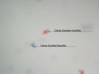 Célula Epitelial Acidófila  Célula Epitelial Basófila 