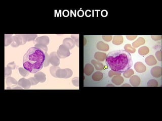 MONÓCITO
 