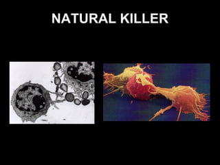 NATURAL KILLER
 