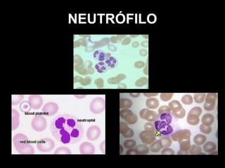 NEUTRÓFILO
 