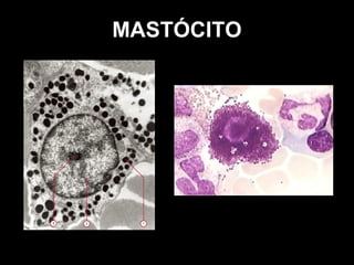 MASTÓCITO
 