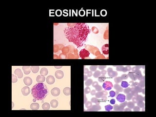 EOSINÓFILO
 