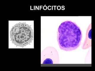 LINFÓCITOS
 