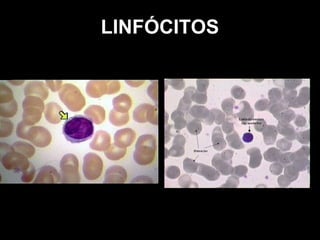 LINFÓCITOS
 