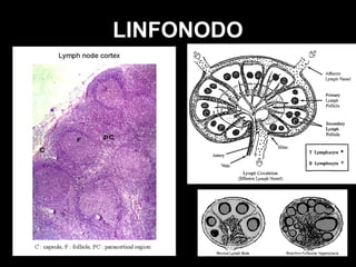 LINFONODO
 