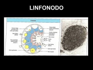 LINFONODO
 