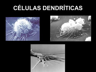 CÉLULAS DENDRÍTICAS
 