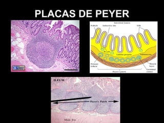 PLACAS DE PEYER
 