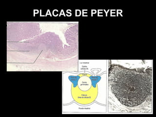 PLACAS DE PEYER
 