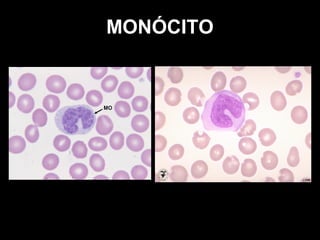 MONÓCITO
 