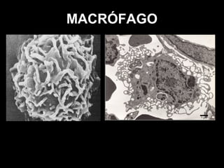 MACRÓFAGO

 