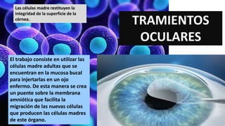 TRAMIENTOS
OCULARES
El trabajo consiste en utilizar las
células madre adultas que se
encuentran en la mucosa bucal
para injertarlas en un ojo
enfermo. De esta manera se crea
un puente sobre la membrana
amniótica que facilita la
migración de las nuevas células
que producen las células madres
de este órgano.
Las células madre restituyen la
integridad de la superficie de la
córnea.
 